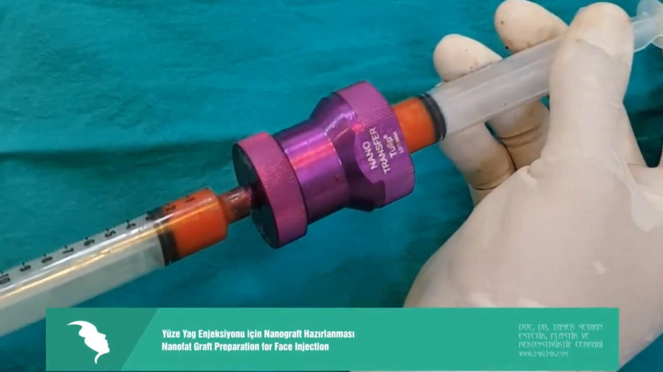 Nanograph preparation for face injection